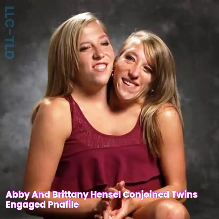 Abby and brittany hensel conjoined twins engaged pnafile