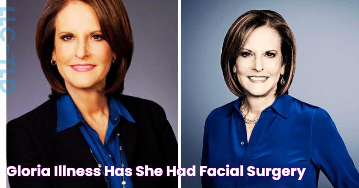 Gloria Illness Has She Had Facial Surgery?