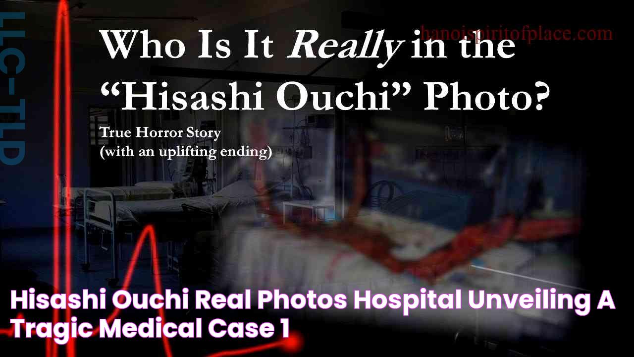 Hisashi Ouchi Real Photos Hospital Unveiling a Tragic Medical Case