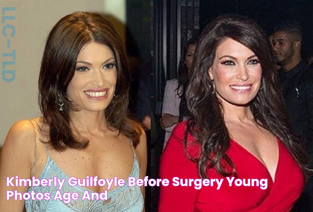 Kimberly Guilfoyle Before Surgery, Young Photos Age And