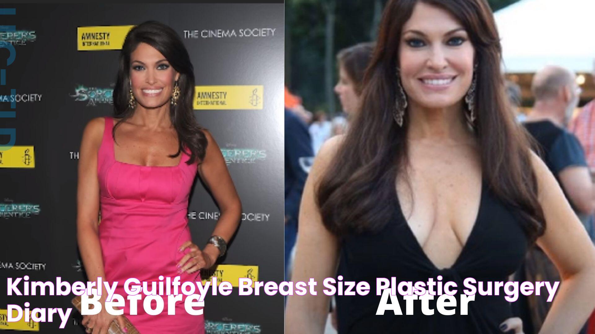 Kimberly Guilfoyle Breast Size Plastic Surgery Diary