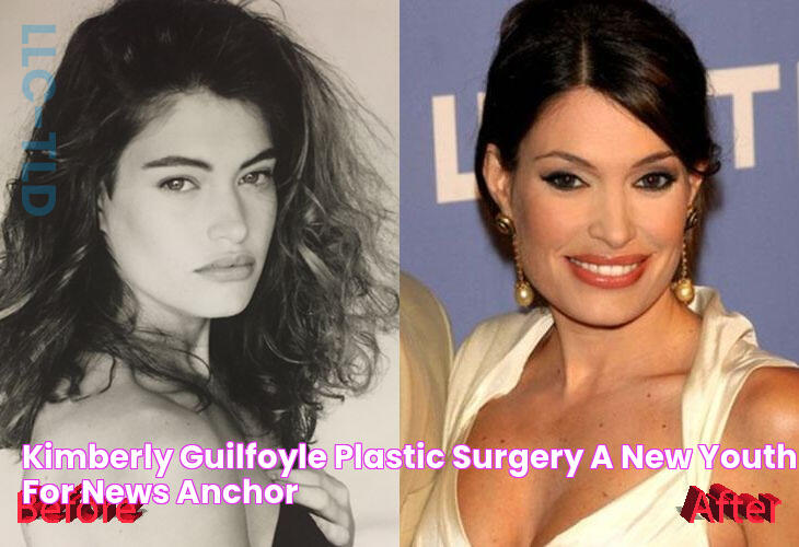 Kimberly Guilfoyle Plastic Surgery A New Youth For News Anchor