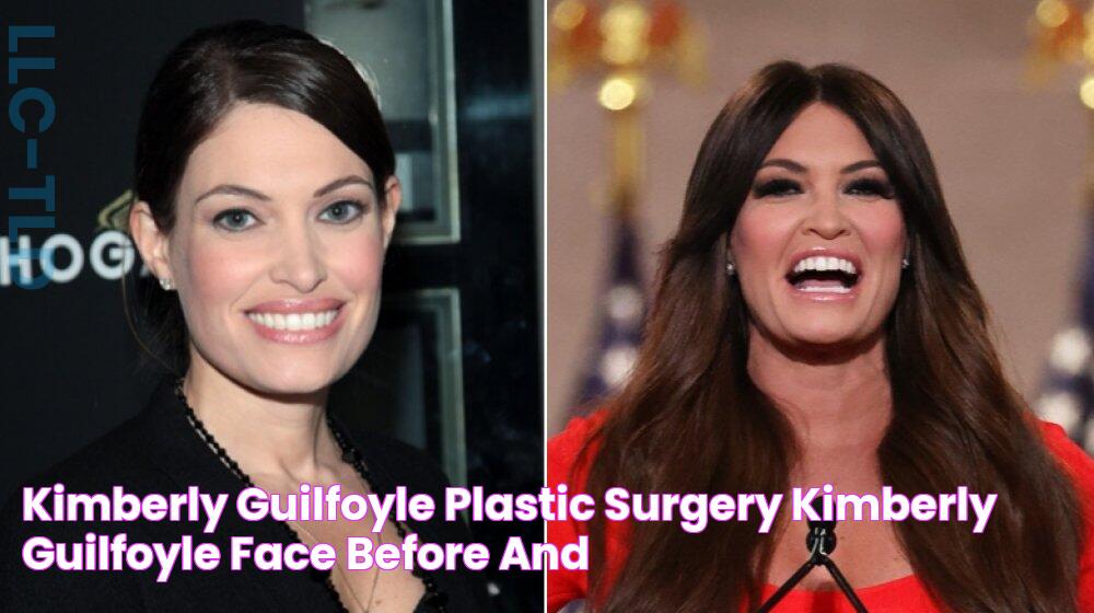 Kimberly Guilfoyle Plastic Surgery Kimberly Guilfoyle Face Before And