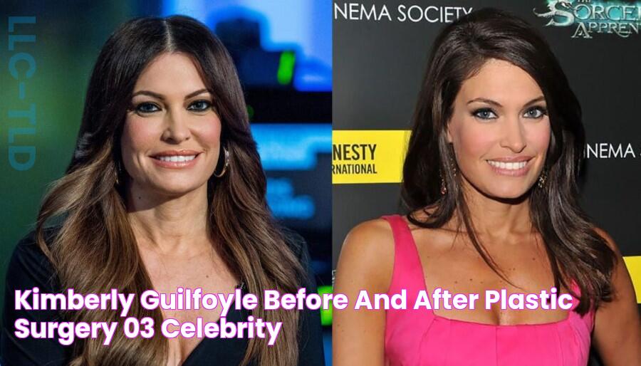 Kimberly Guilfoyle before and after plastic surgery 03 Celebrity