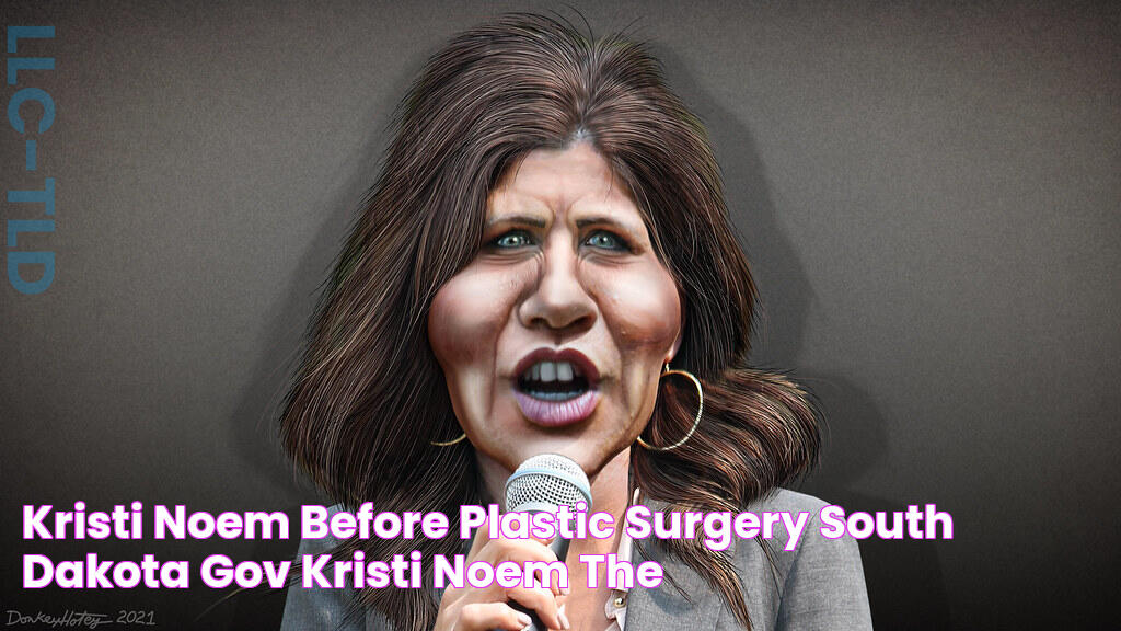 Kristi Noem Before Plastic Surgery South Dakota Gov Kristi Noem The