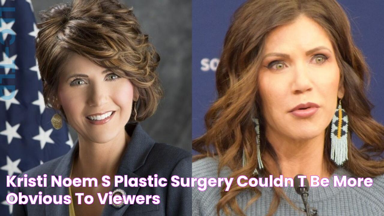 Kristi Noem's Plastic Surgery Couldn't Be More Obvious to Viewers