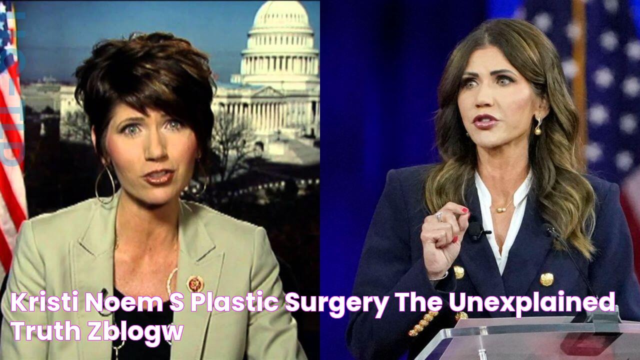 Kristi Noem's Plastic Surgery The Unexplained Truth! ZBlogW