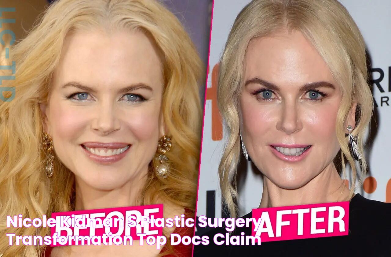 Nicole Kidman’s Plastic Surgery Transformation Top Docs Claim