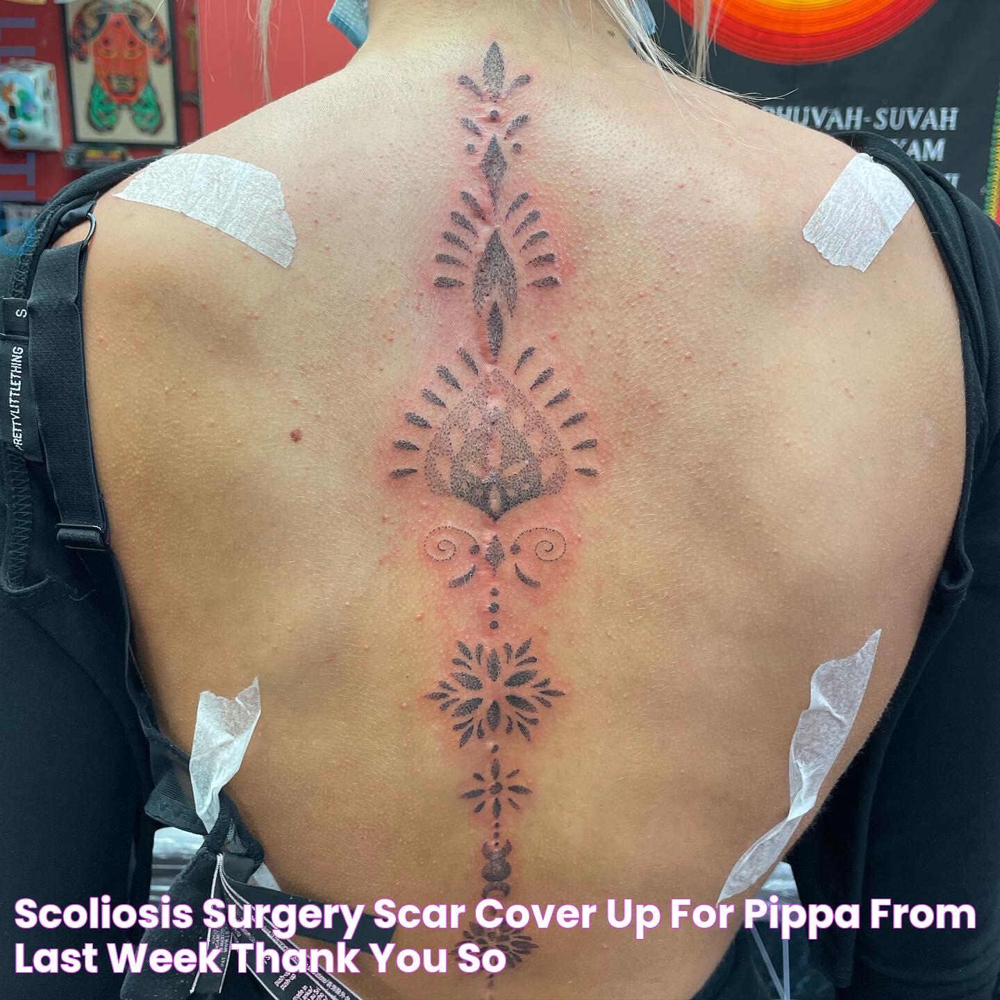 Scoliosis surgery scar cover up for Pippa from last week thank you so