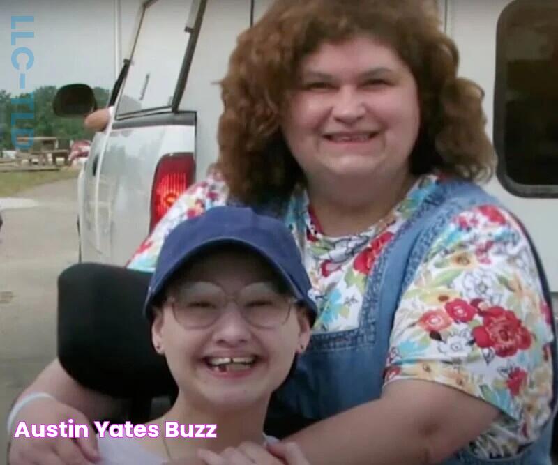 Austin Yates Buzz