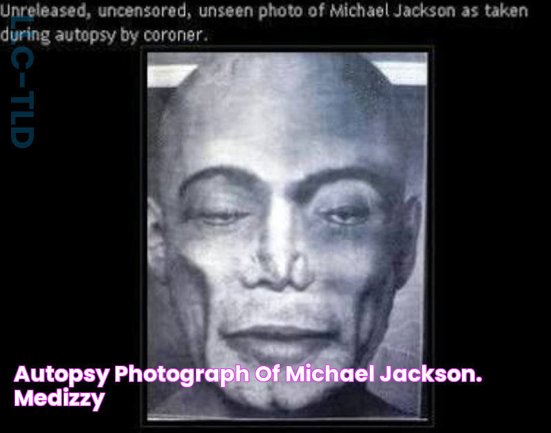 Autopsy photograph of Michael Jackson. MEDizzy