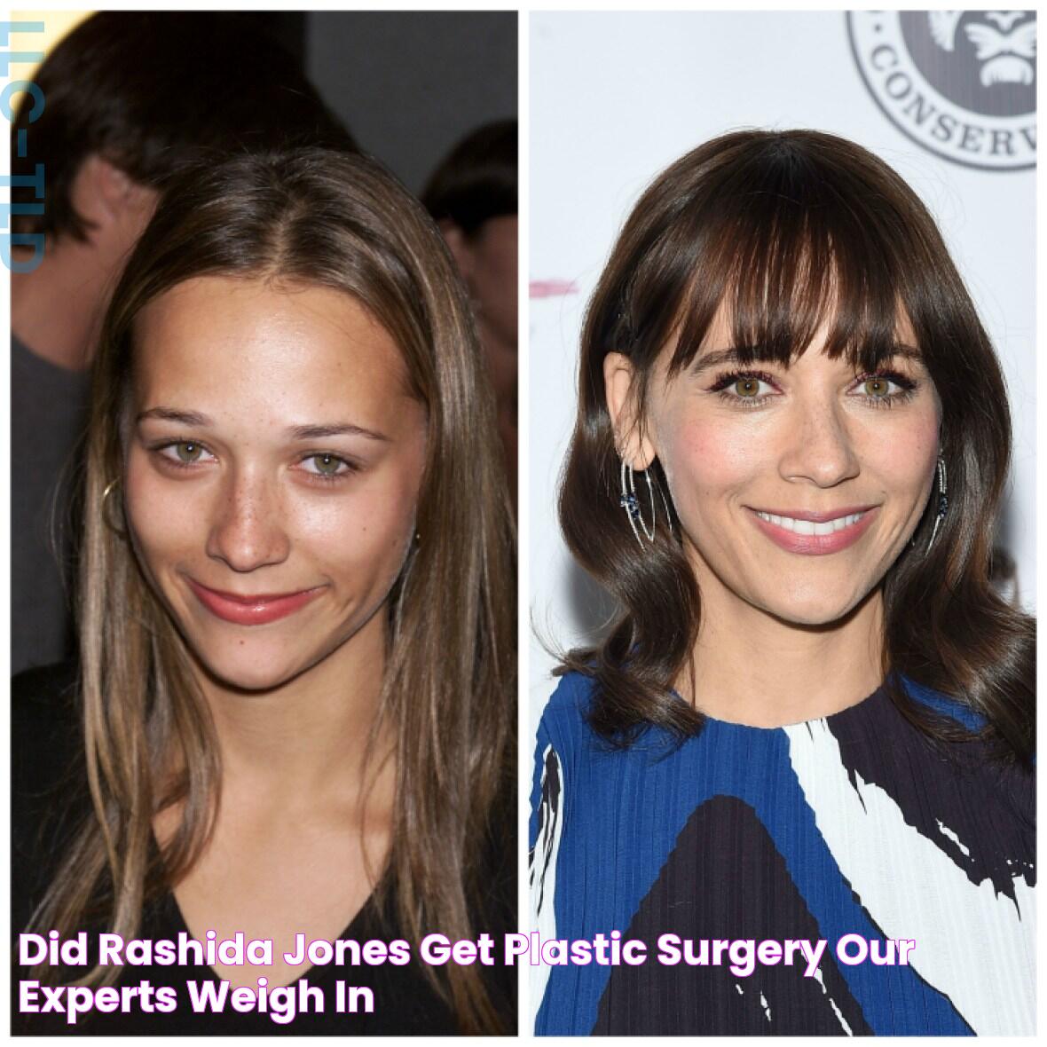 Did Rashida Jones Get Plastic Surgery? Our Experts Weigh In!