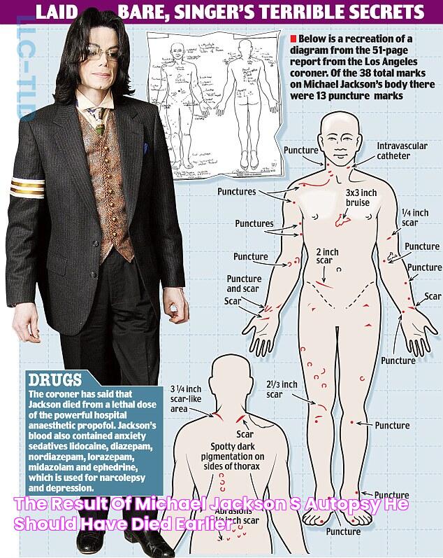 THE RESULT OF MICHAEL JACKSON'S AUTOPSY, HE SHOULD HAVE DIED EARLIER