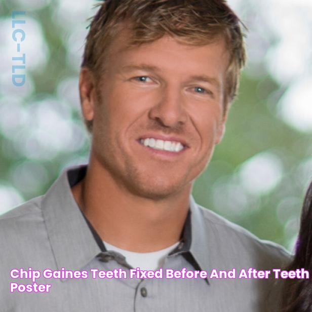 Chip Gaines Teeth Fixed Before And After Teeth Poster