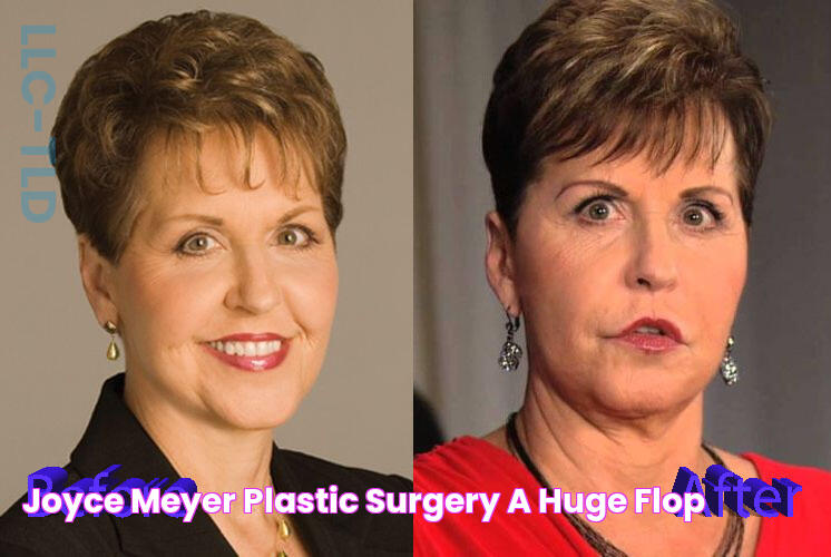 Joyce Meyer Plastic Surgery A Huge Flop