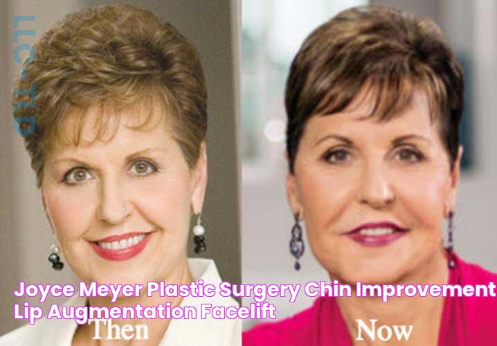 Joyce Meyer Plastic Surgery Chin Improvement, Lip augmentation, Facelift