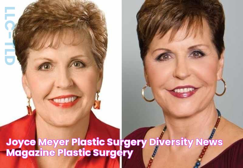 Joyce Meyer Plastic Surgery Diversity News Magazine Plastic surgery