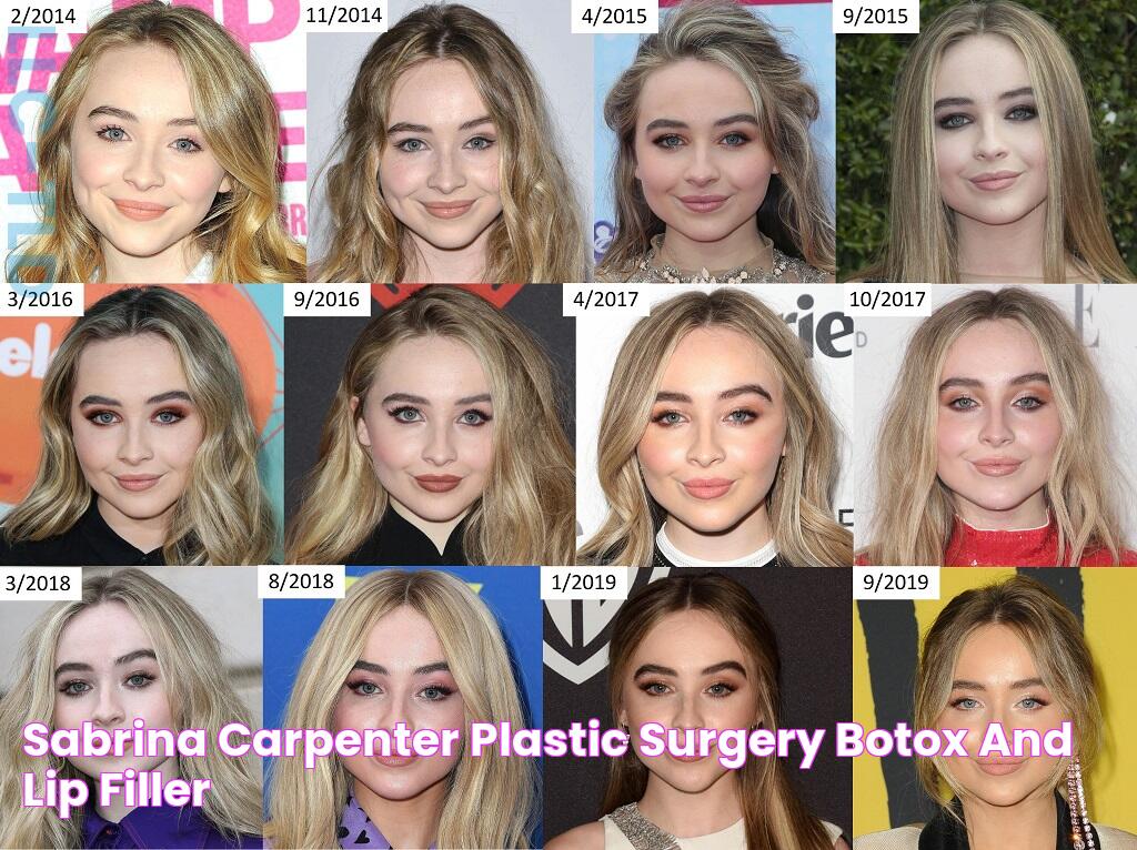 Sabrina Carpenter Plastic Surgery Botox And Lip Filler