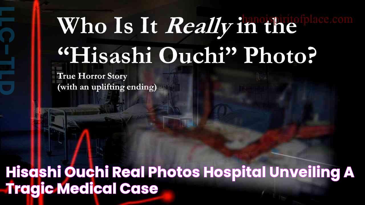 Hisashi Ouchi Real Photos Hospital Unveiling a Tragic Medical Case