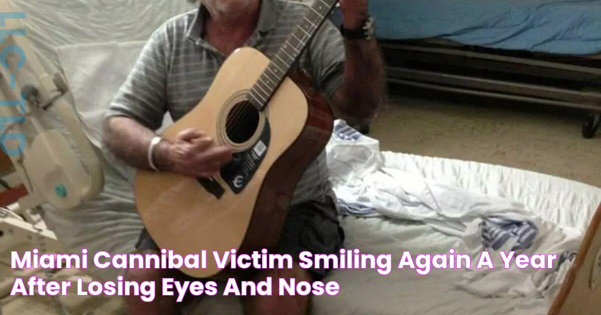 Miami Cannibal victim smiling again a year after losing eyes and nose