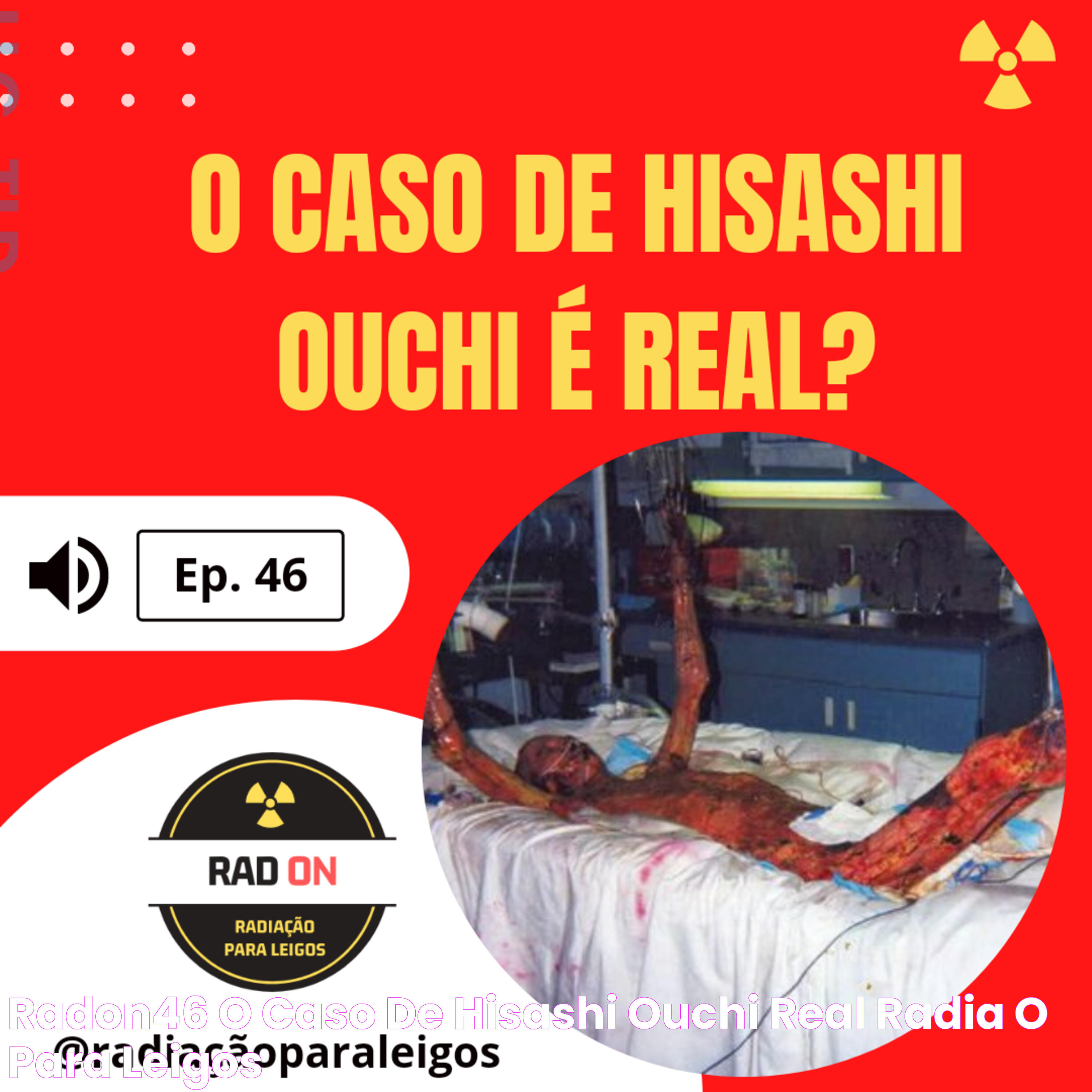 RadOn46 O caso de Hisashi Ouchi é real? Radiação para Leigos