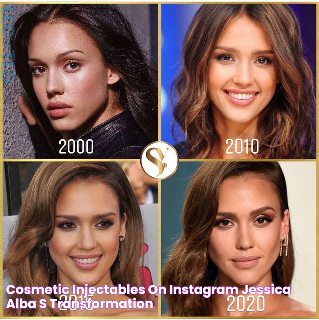 Cosmetic Injectables 🇬🇧 on Instagram “Jessica Alba's transformation