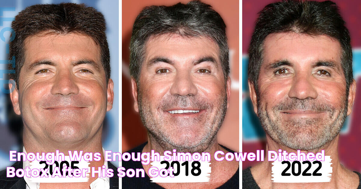 “Enough Was Enough,” Simon Cowell Ditched Botox After His Son Got