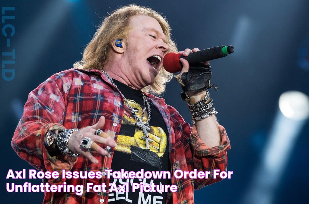 Axl Rose Issues Takedown Order For Unflattering 'Fat Axl' Picture