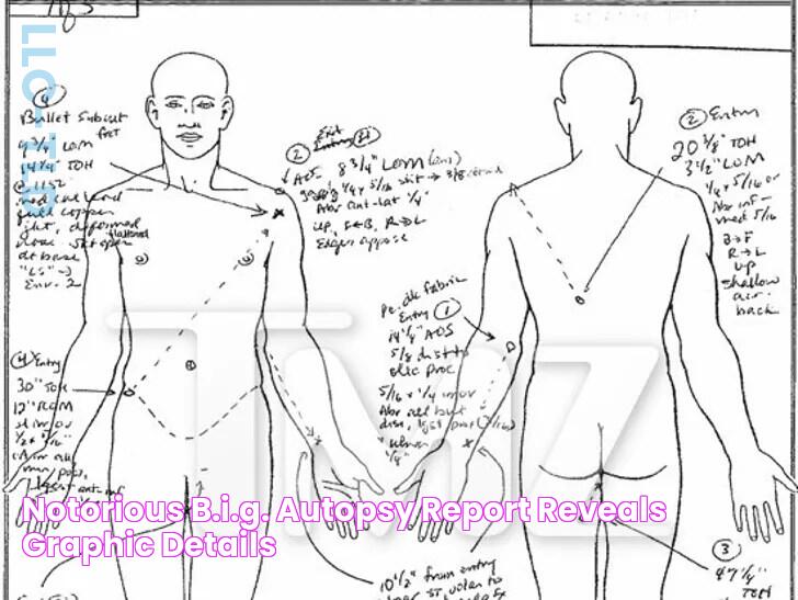 Notorious B.I.G. AUTOPSY REPORT Reveals Graphic Details