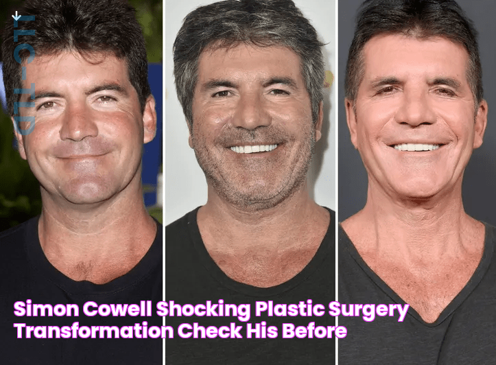 Simon Cowell Shocking Plastic Surgery Transformation Check His Before