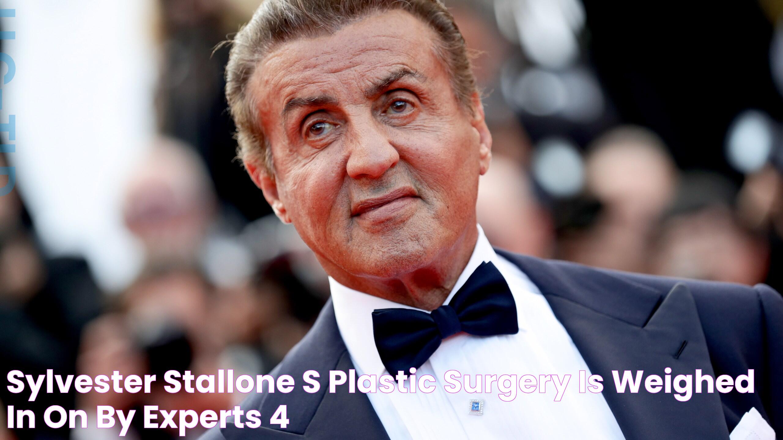 Sylvester Stallone's Plastic Surgery Is Weighed in on by Experts