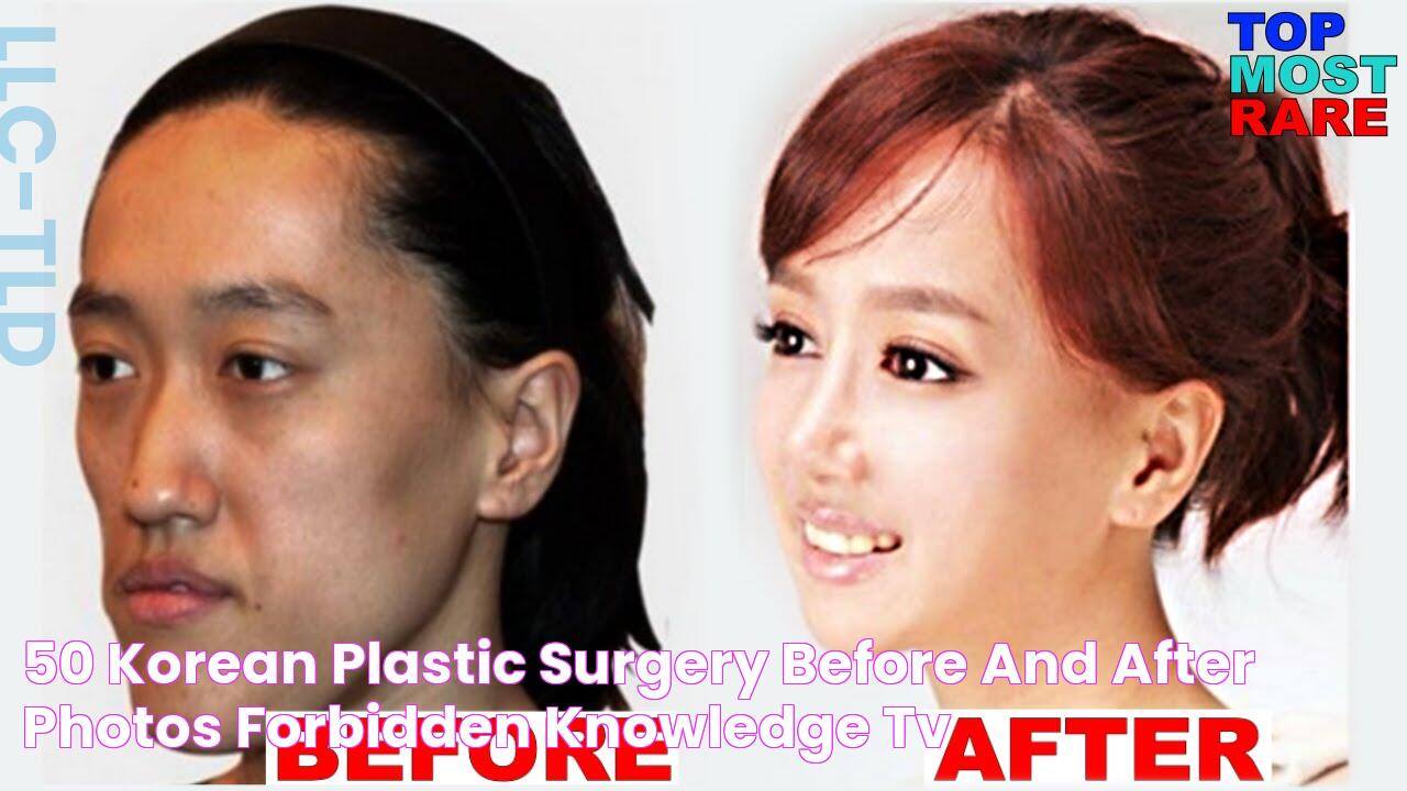 50 Korean Plastic Surgery Before and After Photos Forbidden Knowledge TV