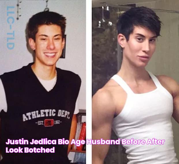 Justin Jedlica Bio, Age, Husband, Before After Look, Botched