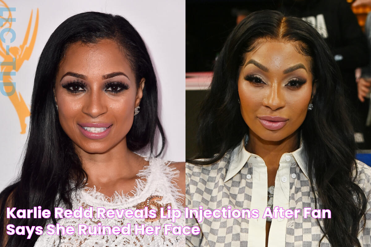 Karlie Redd Reveals 'Lip Injections' After Fan Says She Ruined Her Face