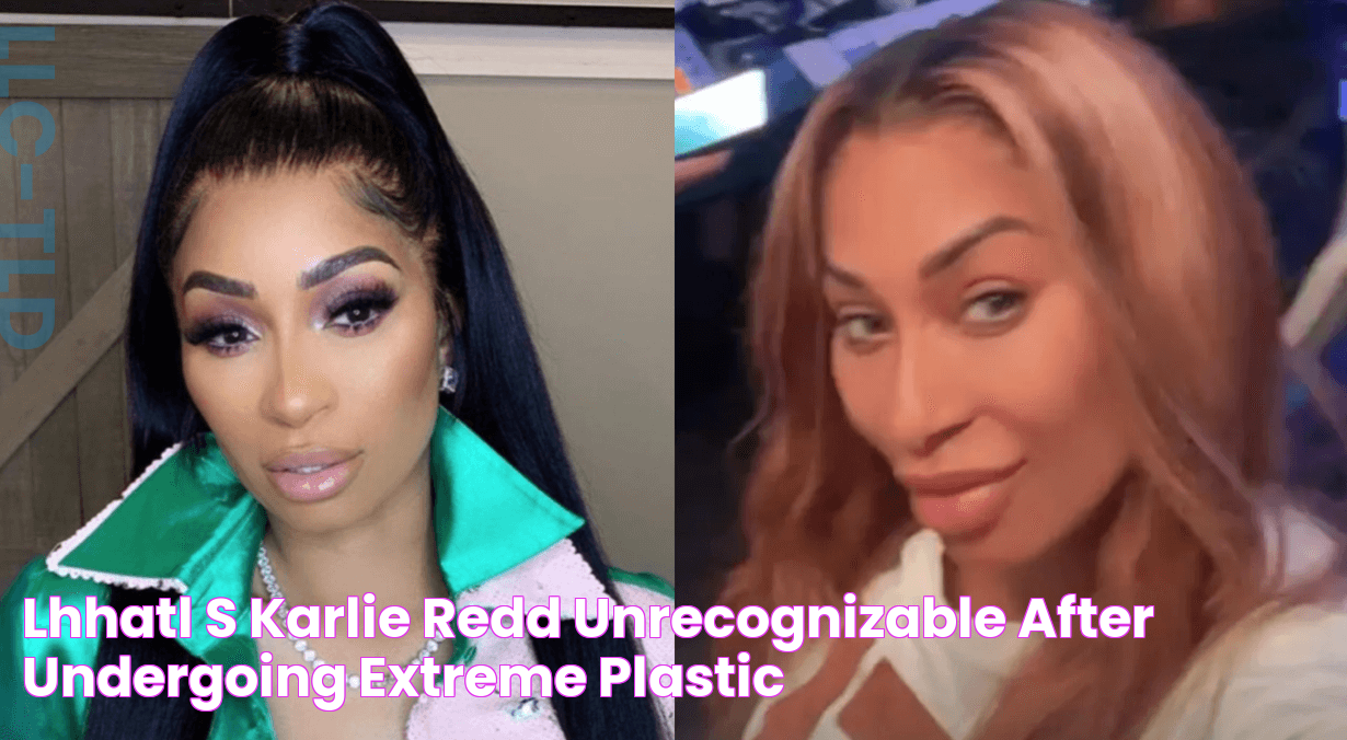 LHHATL’s Karlie Redd Unrecognizable After Undergoing EXTREME Plastic