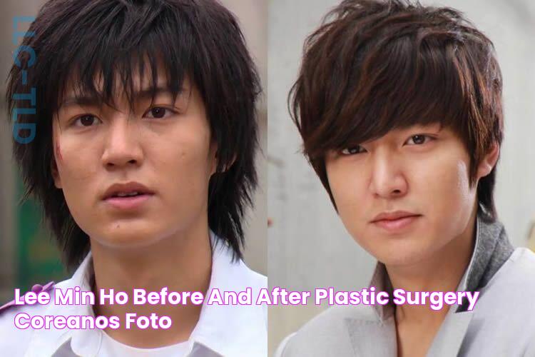 Lee Min Ho Before and After Plastic Surgery? Coreanos, Foto