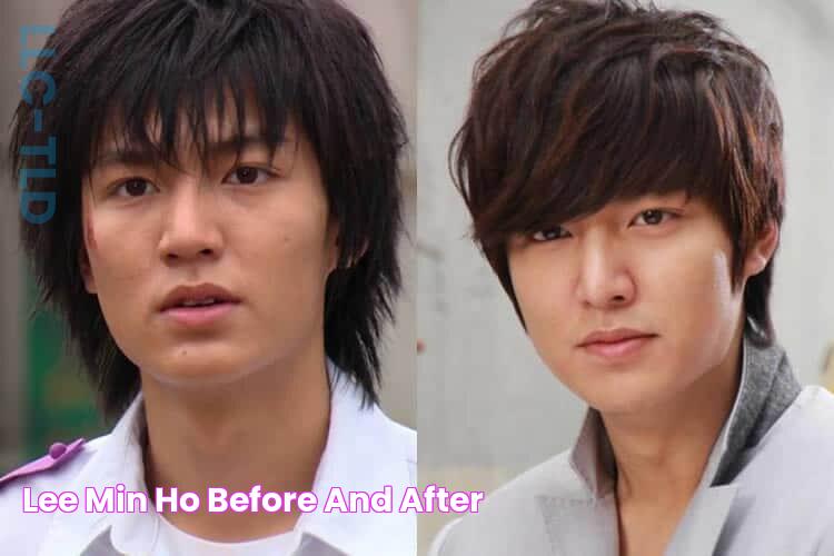 Lee Min Ho, Before and After