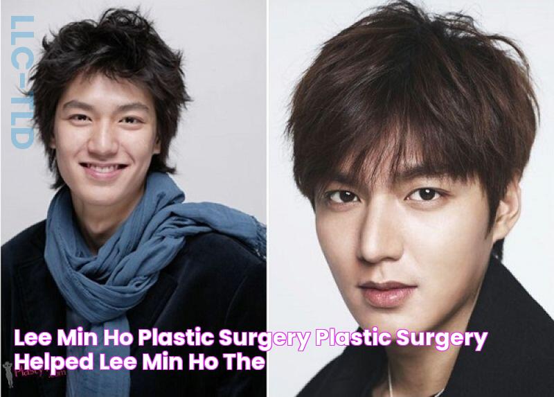 Lee Min Ho Plastic Surgery plastic surgery helped lee min ho the