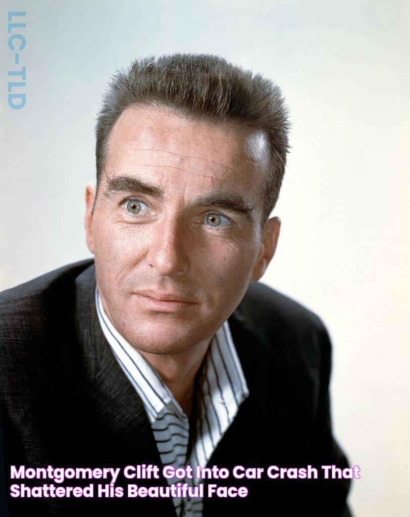 Montgomery Clift Got into Car Crash that Shattered His Beautiful Face