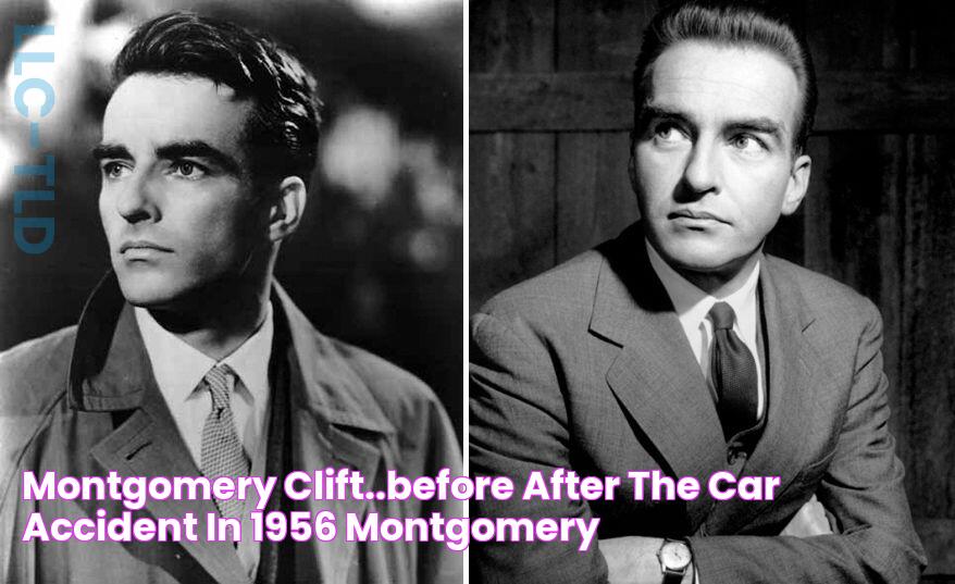 Montgomery Clift..BEFORE & AFTER the car accident in 1956 Montgomery