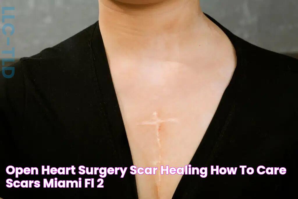 Open Heart Surgery Scar Healing How to care scars Miami, FL