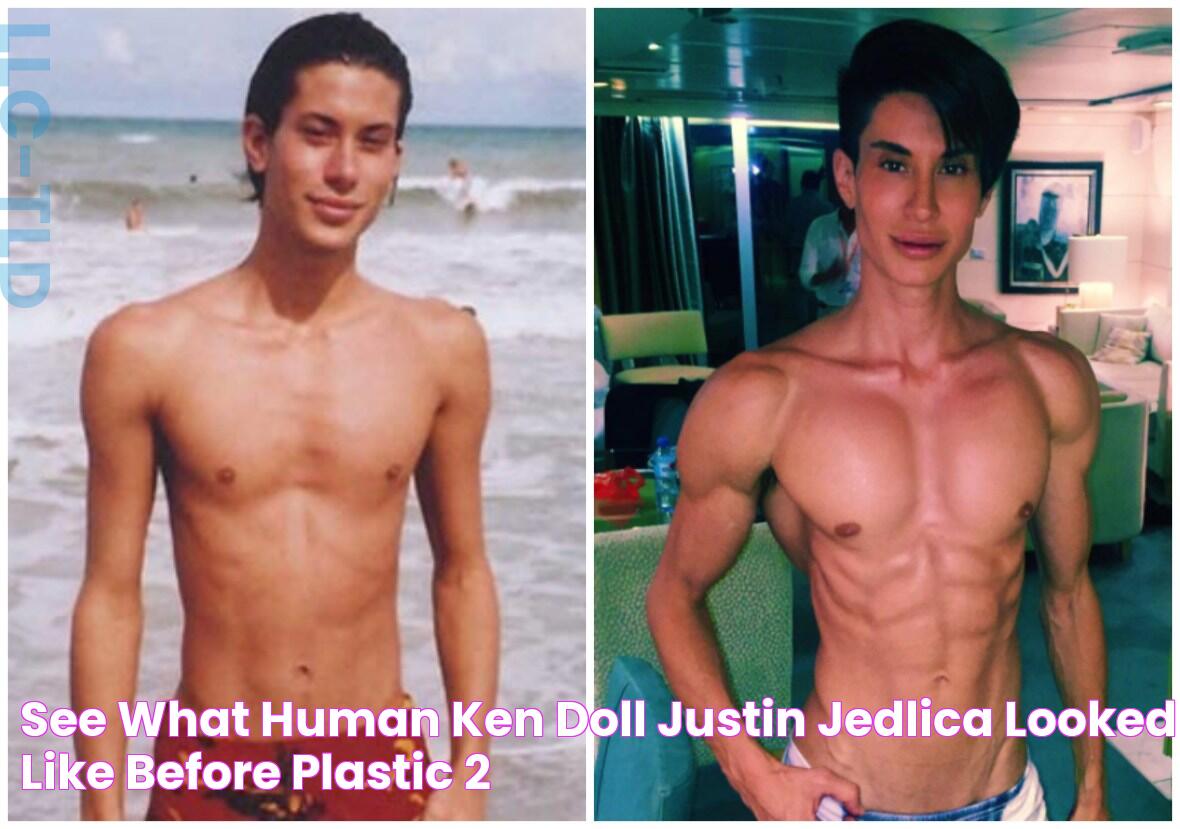 See What "Human Ken Doll" Justin Jedlica Looked Like Before Plastic