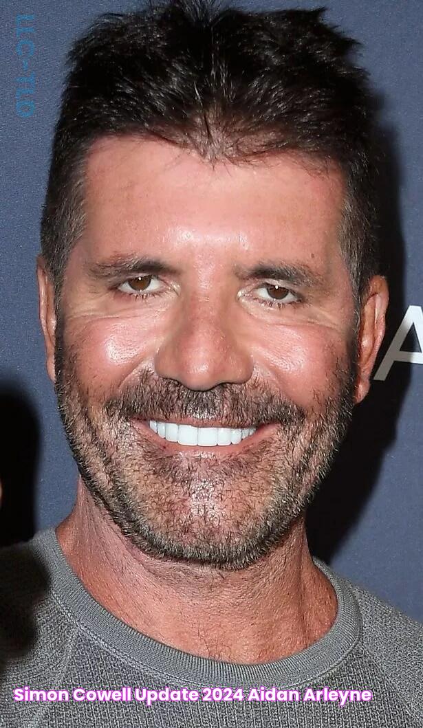 Simon Cowell Update 2024 Aidan Arleyne