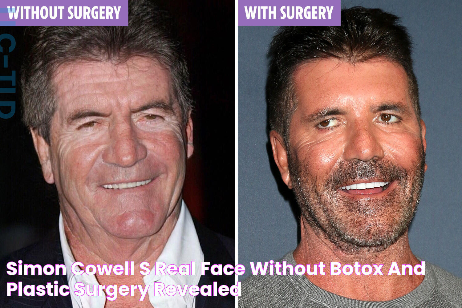 Simon Cowell's 'REAL' face without Botox and plastic surgery revealed