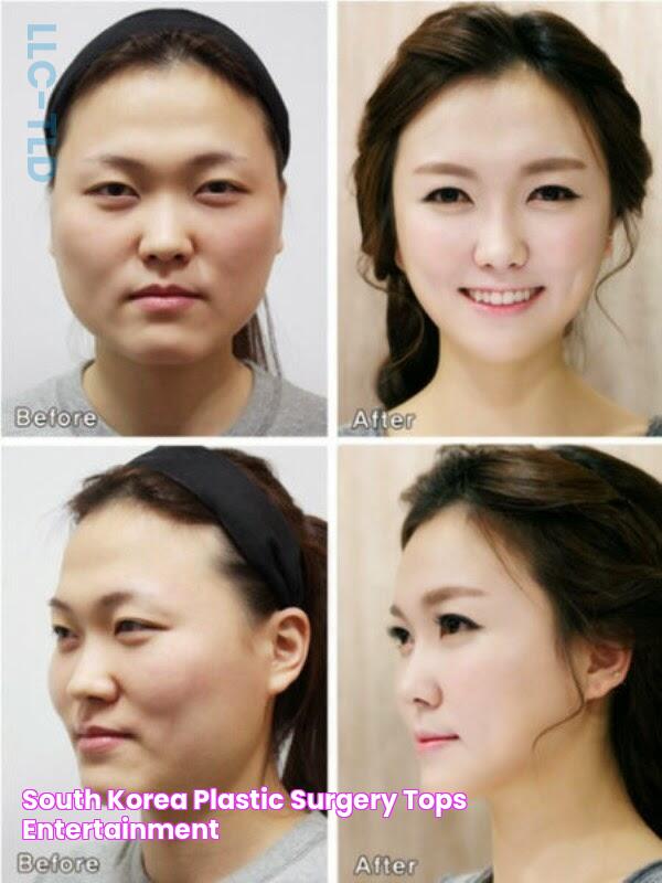 South Korea Plastic Surgery Tops Entertainment