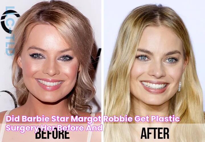 Did "Barbie’ Star Margot Robbie Get Plastic Surgery? Her Before And