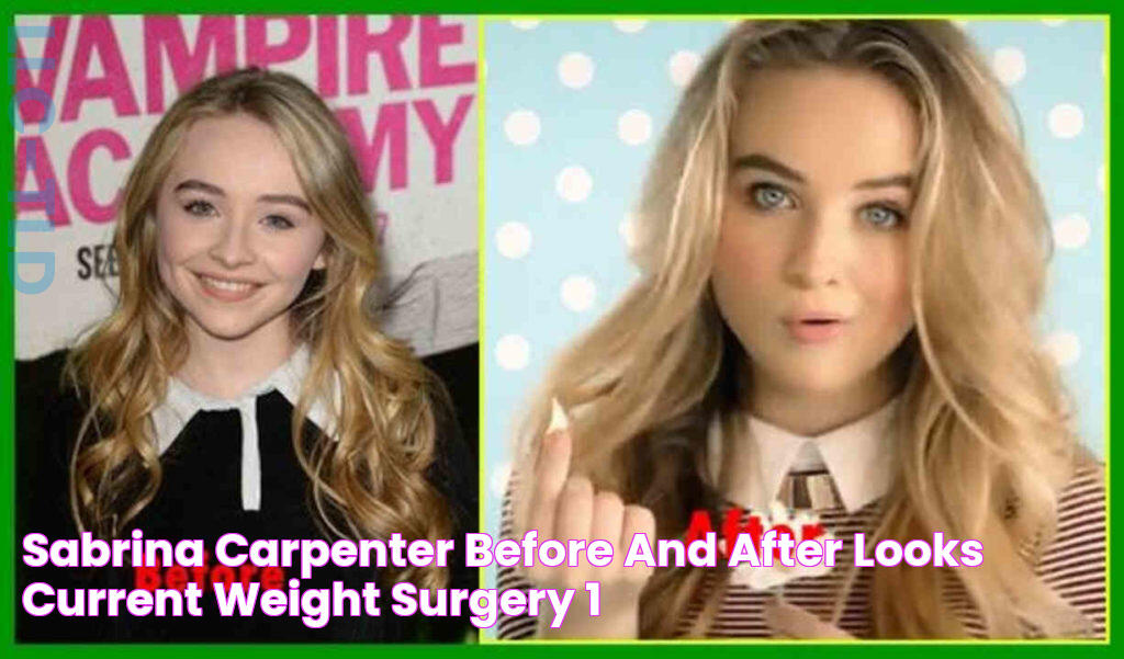 Sabrina Carpenter Before and After Looks, Current Weight, Surgery