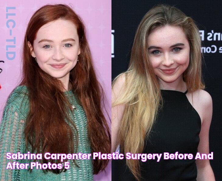 Sabrina Carpenter Plastic Surgery Before And After Photos