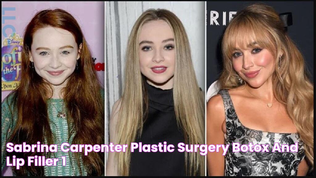 Sabrina Carpenter Plastic Surgery Botox And Lip Filler