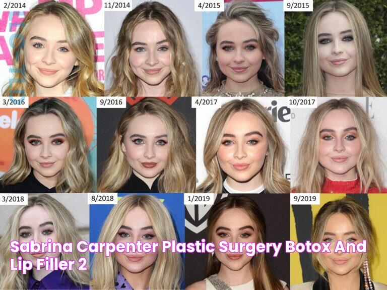 Sabrina Carpenter Plastic Surgery Botox And Lip Filler